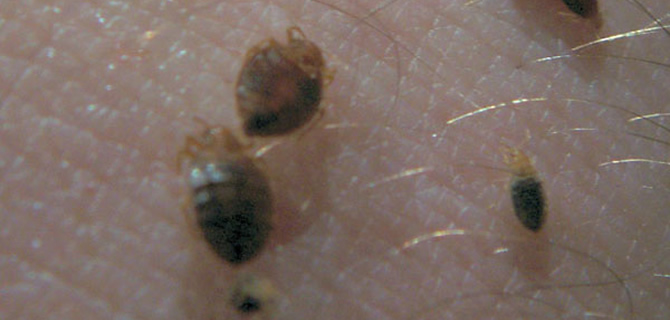 Bed Bugs infestation Wolverhampton Pest Control Bedbug Infestation